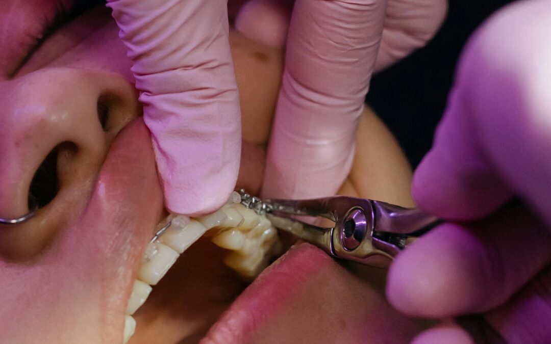 aparat ortodontyczny